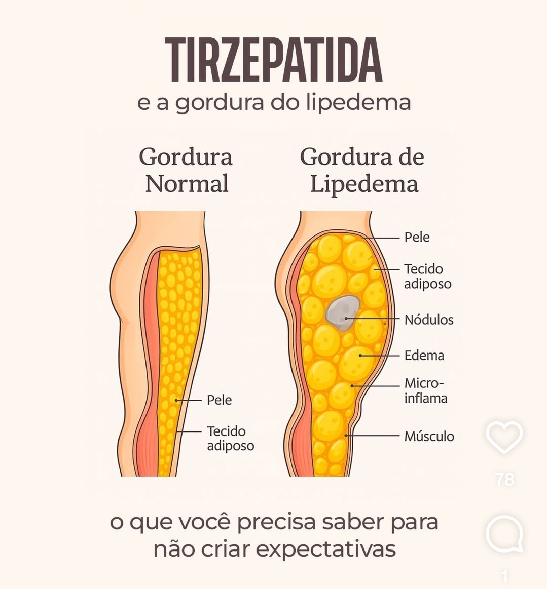 tg.tirze.campinas - Video 16