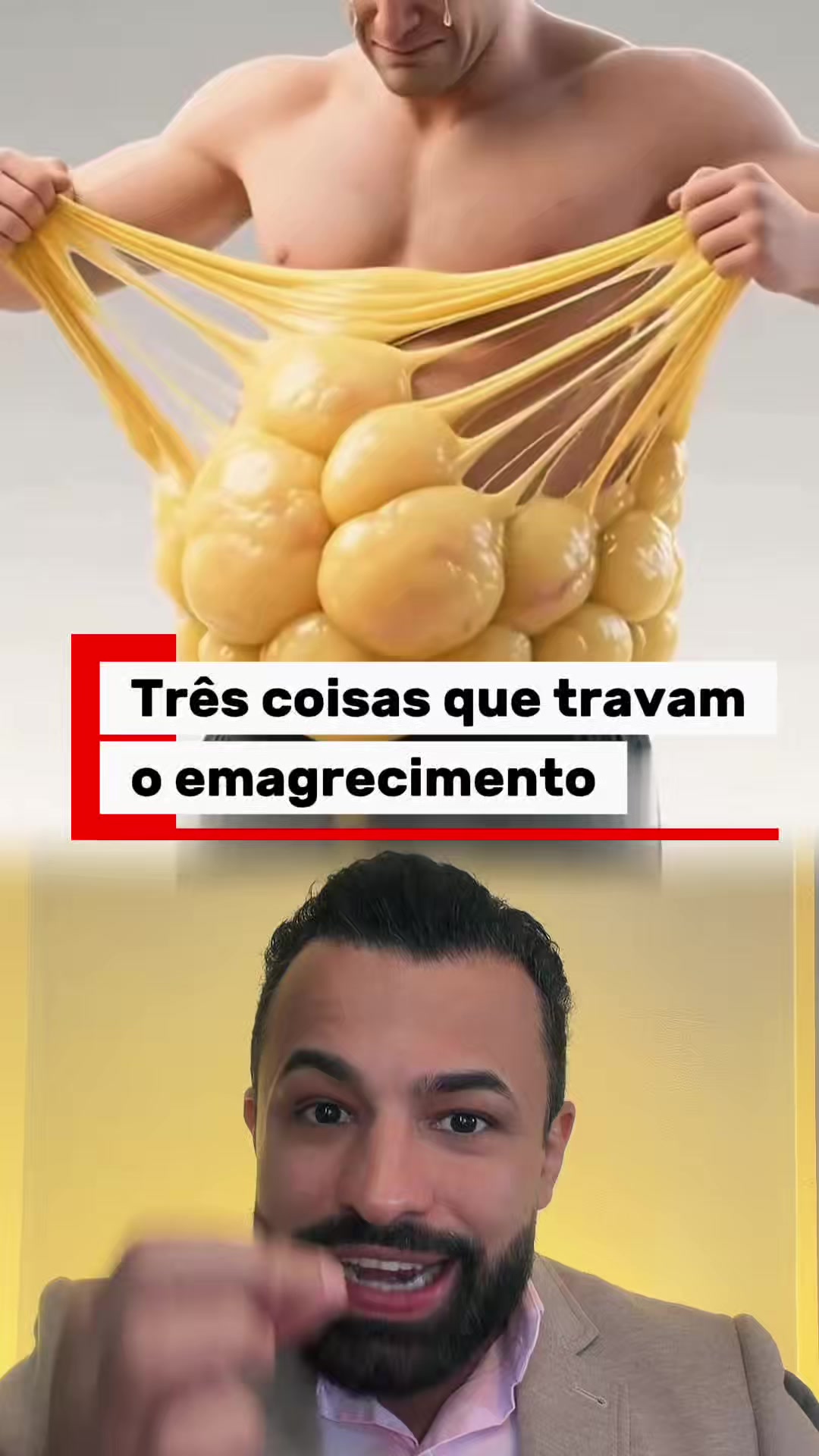 dr.marcelo.santos - Video 34
