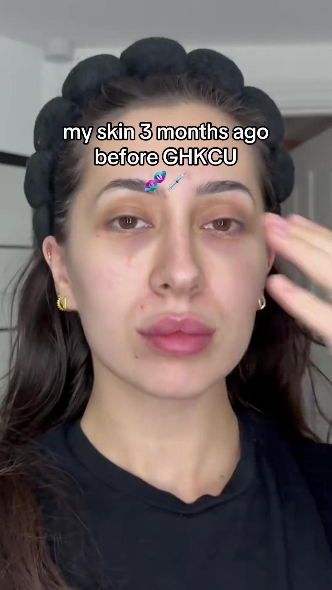 Let’s talk results : Ghkcu is not magic, it simply activates signals ...