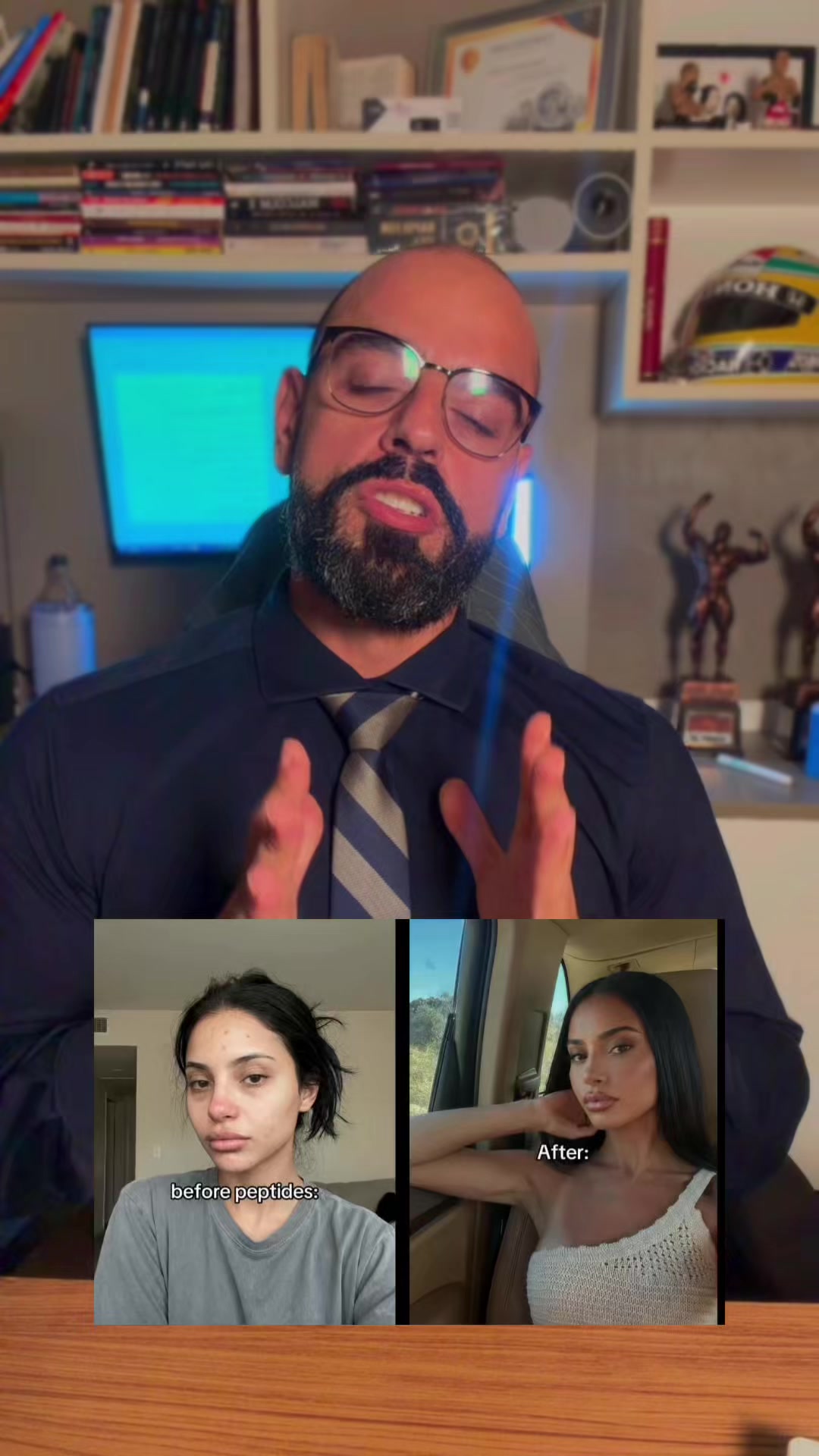teambechara - Video 30